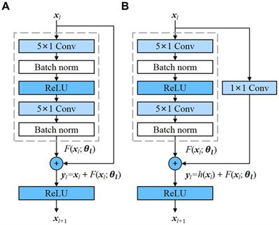 Residual and bidirectional LSTM for epileptic seizure detection